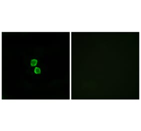 Immunofluorescence - Anti-CKLF1 Antibody (C15131) - Antibodies.com