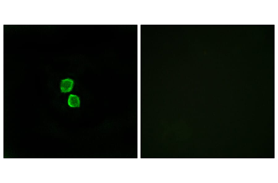 Immunofluorescence - Anti-CKLF1 Antibody (C15131) - Antibodies.com