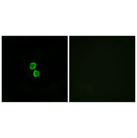 Immunofluorescence - Anti-CKLF1 Antibody (C15131) - Antibodies.com