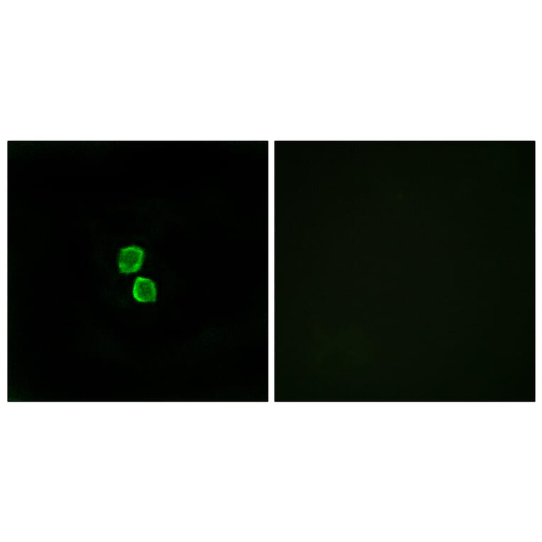 Immunofluorescence - Anti-CKLF1 Antibody (C15131) - Antibodies.com