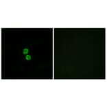Immunofluorescence - Anti-CKLF1 Antibody (C15131) - Antibodies.com