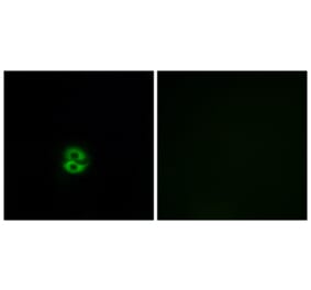 Immunofluorescence - Anti-CHST6 Antibody (C14929) - Antibodies.com