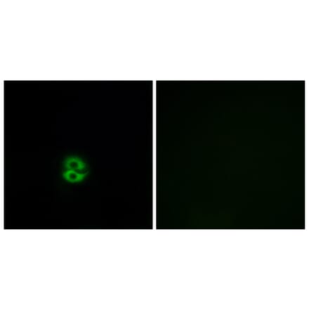 Immunofluorescence - Anti-CHST6 Antibody (C14929) - Antibodies.com