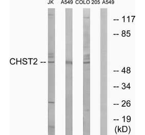 Western Blot - Anti-CHST2 Antibody (C14925) - Antibodies.com