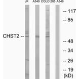 Western Blot - Anti-CHST2 Antibody (C14925) - Antibodies.com