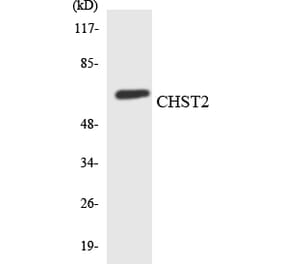 Western Blot - Anti-CHST2 Antibody (R12-2617) - Antibodies.com