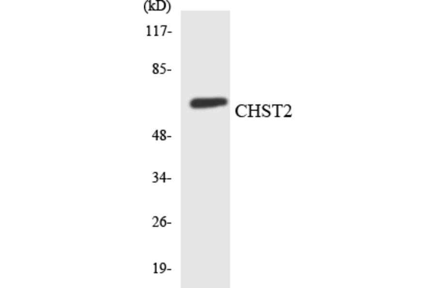 Western Blot - Anti-CHST2 Antibody (R12-2617) - Antibodies.com