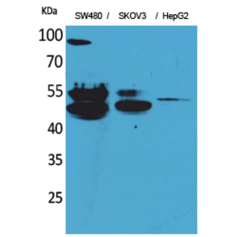 Western Blot - Anti-CFLAR Antibody (C30033) - Antibodies.com