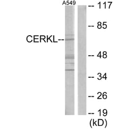 Western Blot - Anti-CERKL Antibody (C11160) - Antibodies.com