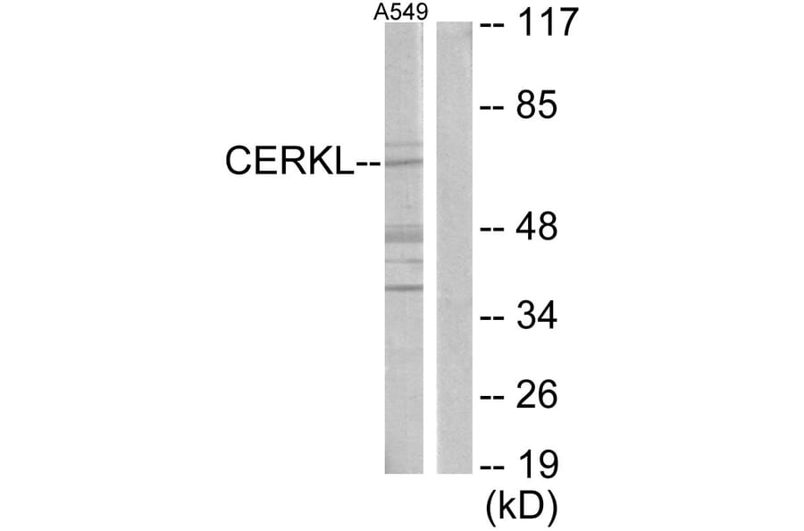 Western Blot - Anti-CERKL Antibody (C11160) - Antibodies.com