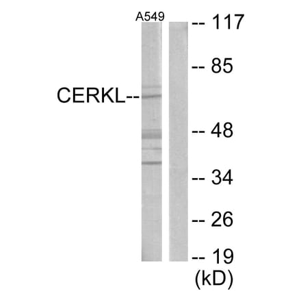 Western Blot - Anti-CERKL Antibody (C11160) - Antibodies.com