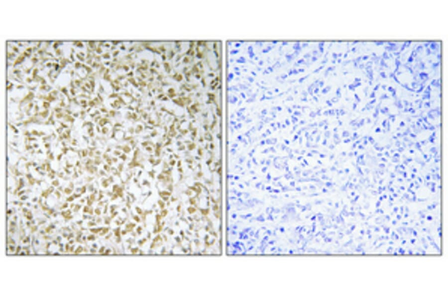Immunohistochemistry - Anti-CERKL Antibody (C11160) - Antibodies.com