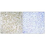 Immunohistochemistry - Anti-CERKL Antibody (C11160) - Antibodies.com