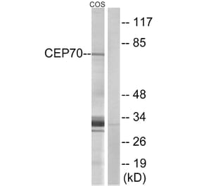 Western Blot - Anti-CEP70 Antibody (C15047) - Antibodies.com