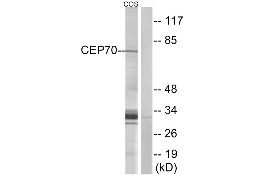 Western Blot - Anti-CEP70 Antibody (C15047) - Antibodies.com