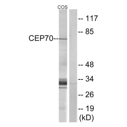 Western Blot - Anti-CEP70 Antibody (C15047) - Antibodies.com