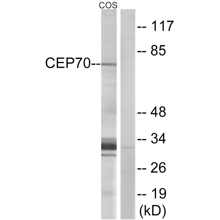 Western Blot - Anti-CEP70 Antibody (C15047) - Antibodies.com