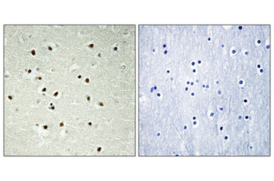 Immunohistochemistry - Anti-CEP70 Antibody (C15047) - Antibodies.com