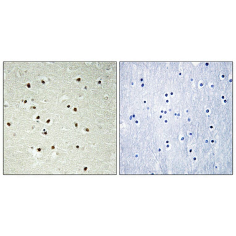 Immunohistochemistry - Anti-CEP70 Antibody (C15047) - Antibodies.com