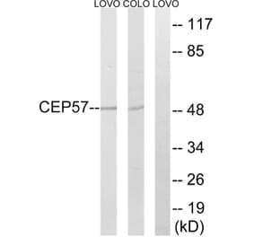 Western Blot - Anti-CEP57 Antibody (C15044) - Antibodies.com