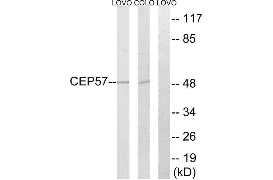Western Blot - Anti-CEP57 Antibody (C15044) - Antibodies.com