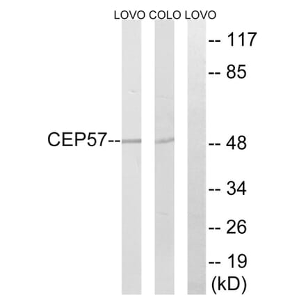 Western Blot - Anti-CEP57 Antibody (C15044) - Antibodies.com