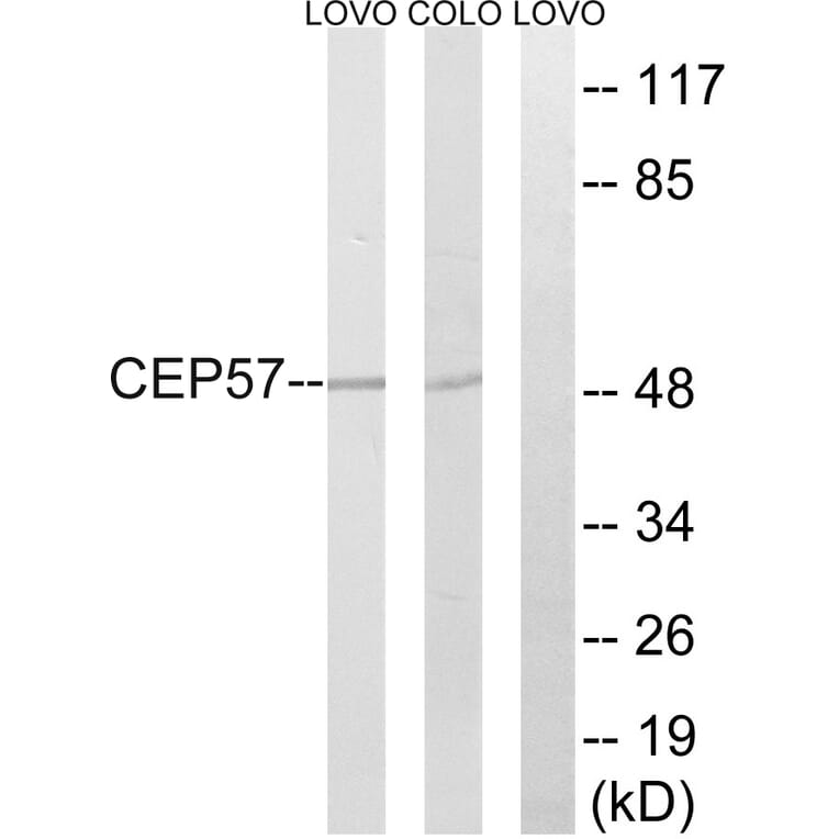Western Blot - Anti-CEP57 Antibody (C15044) - Antibodies.com