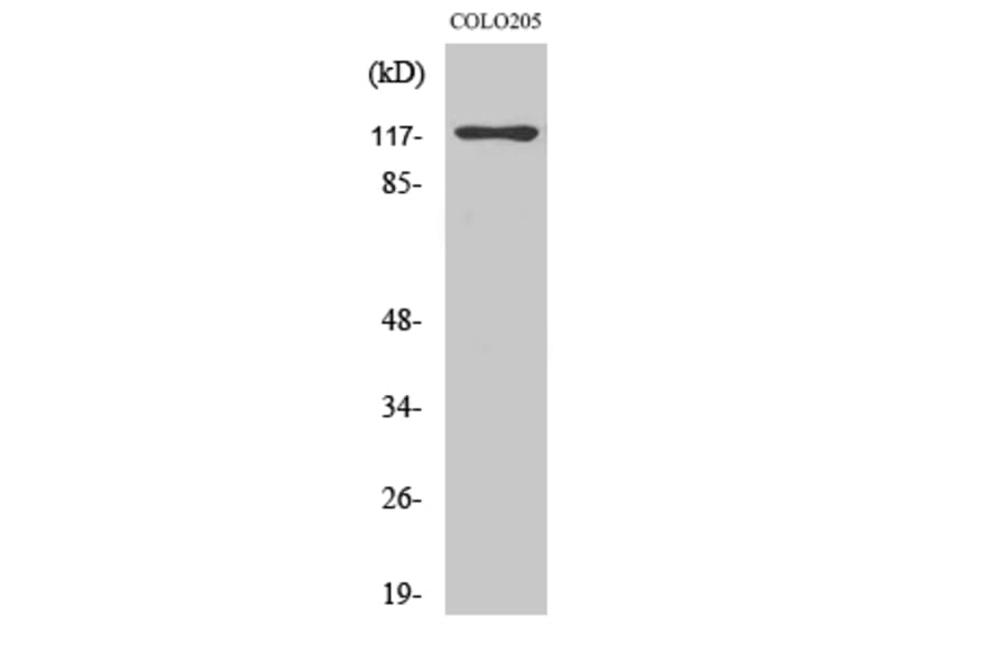 Western Blot - Anti-CEBPZ Antibody (C10870) - Antibodies.com