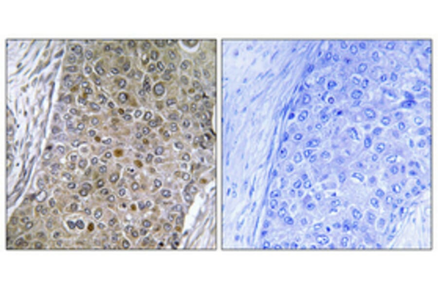 Immunohistochemistry - Anti-CEBPZ Antibody (C10870) - Antibodies.com