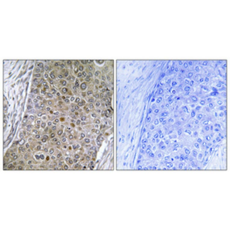Immunohistochemistry - Anti-CEBPZ Antibody (C10870) - Antibodies.com