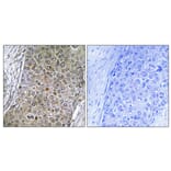 Immunohistochemistry - Anti-CEBPZ Antibody (C10870) - Antibodies.com