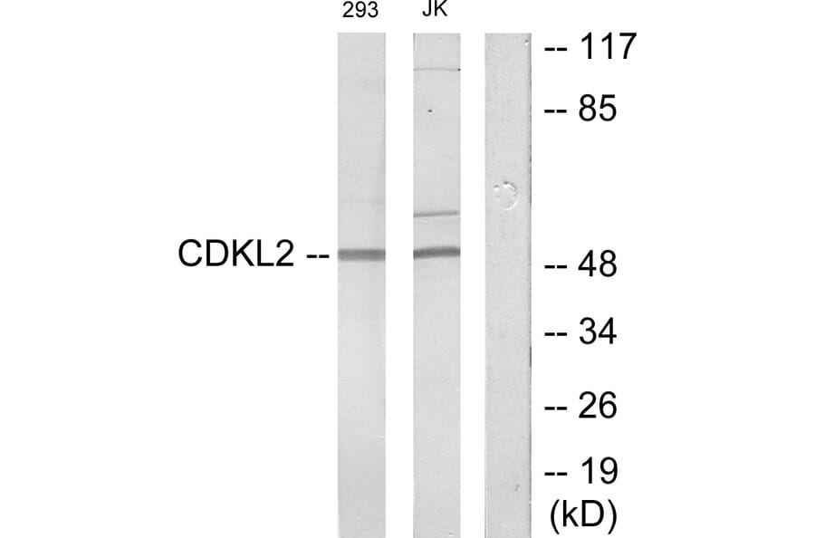Western Blot - Anti-CDKL2 Antibody (C11433) - Antibodies.com