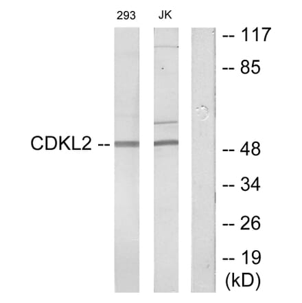 Western Blot - Anti-CDKL2 Antibody (C11433) - Antibodies.com