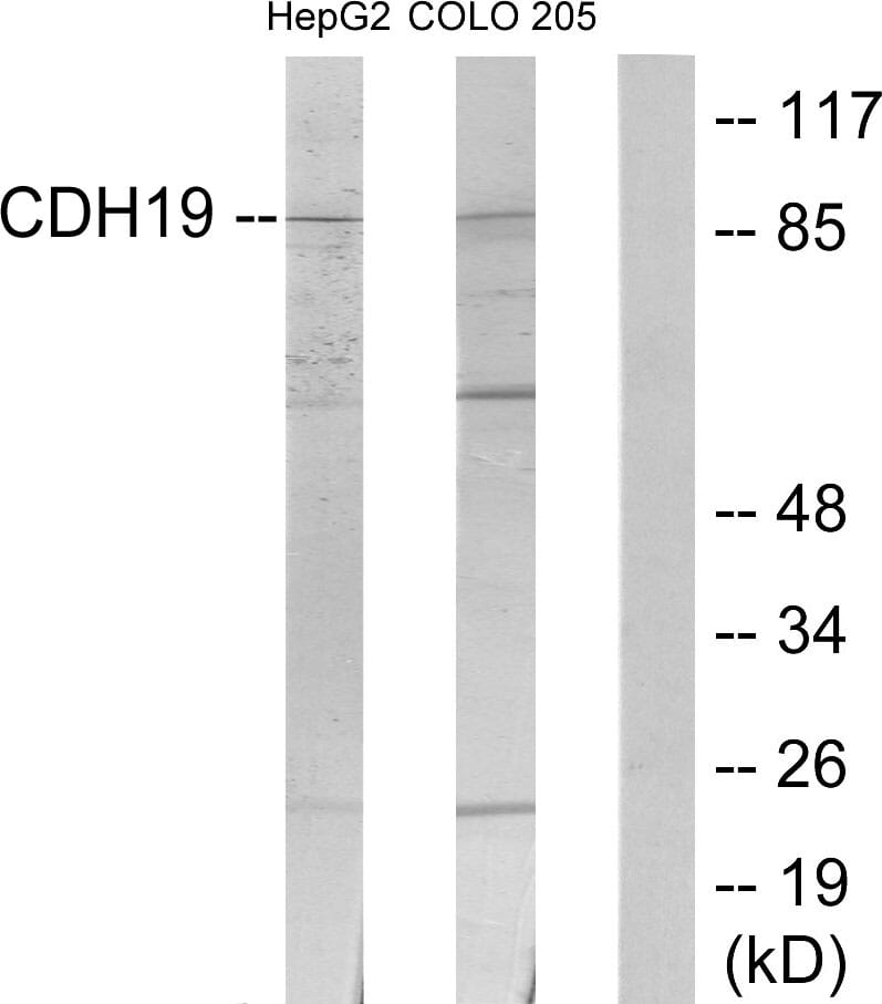Western blot analysis of lysates from HepG2 and COLO205 cells using Anti-CDH19 Antibody. The right hand lane represents a negative control, where the antibody is blocked by the immunising peptide.