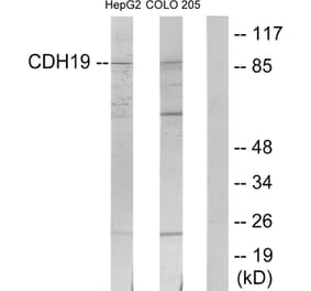 Western Blot - Anti-CDH19 Antibody (C12094) - Antibodies.com