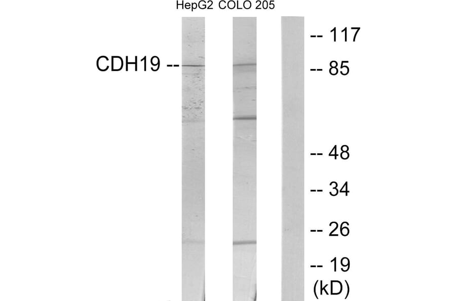 Western Blot - Anti-CDH19 Antibody (C12094) - Antibodies.com
