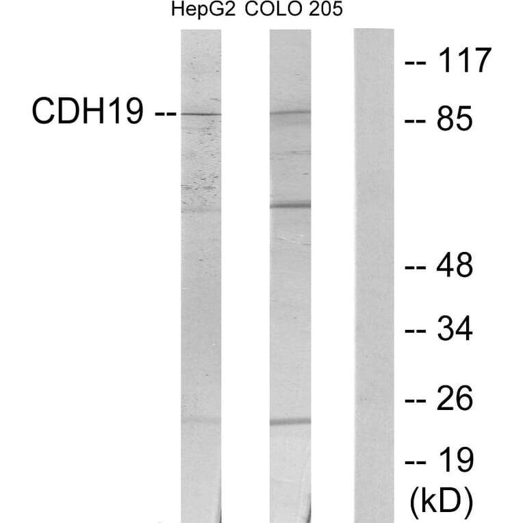 Western Blot - Anti-CDH19 Antibody (C12094) - Antibodies.com