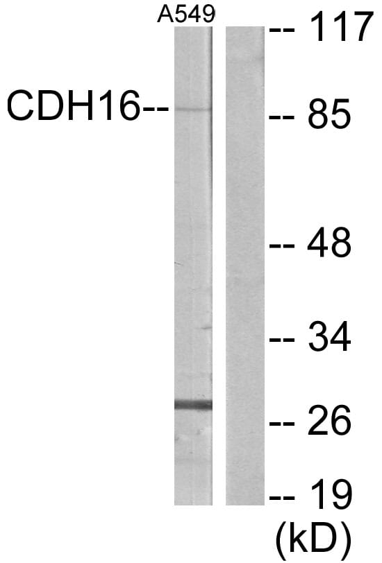 Western blot analysis of lysates from A549 cells using Anti-CDH16 Antibody. The right hand lane represents a negative control, where the antibody is blocked by the immunising peptide.