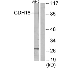 Western Blot - Anti-CDH16 Antibody (C12091) - Antibodies.com