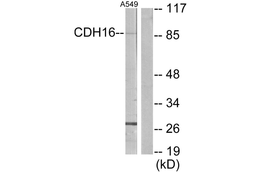 Western Blot - Anti-CDH16 Antibody (C12091) - Antibodies.com