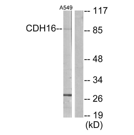 Western Blot - Anti-CDH16 Antibody (C12091) - Antibodies.com