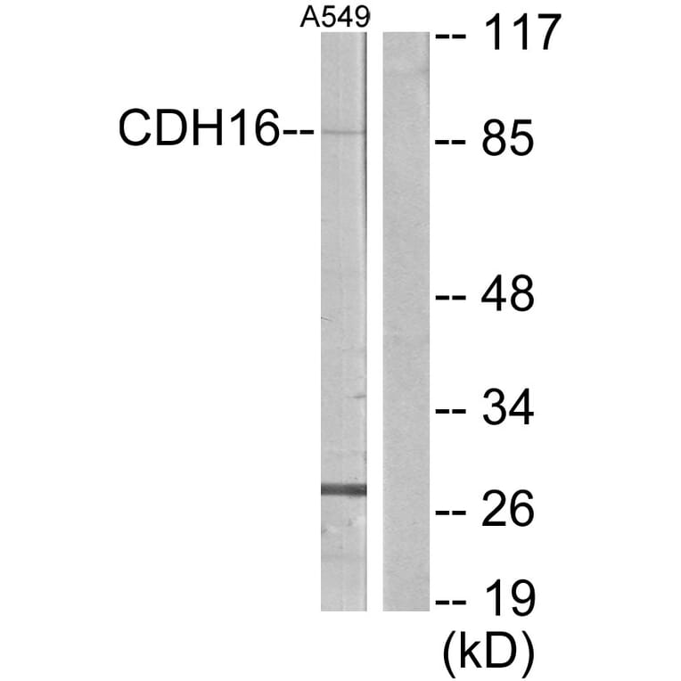 Western Blot - Anti-CDH16 Antibody (C12091) - Antibodies.com