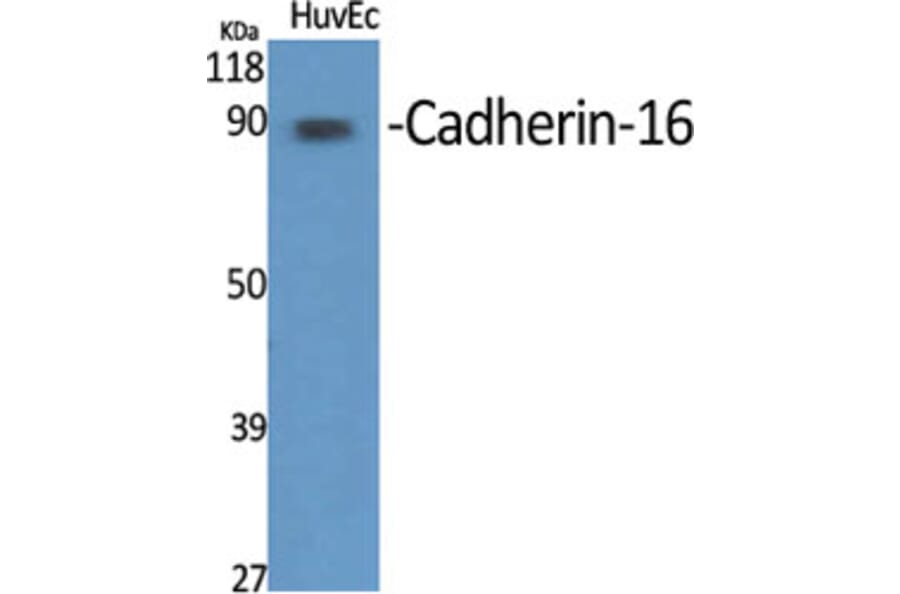 Western Blot - Anti-CDH16 Antibody (C12091) - Antibodies.com