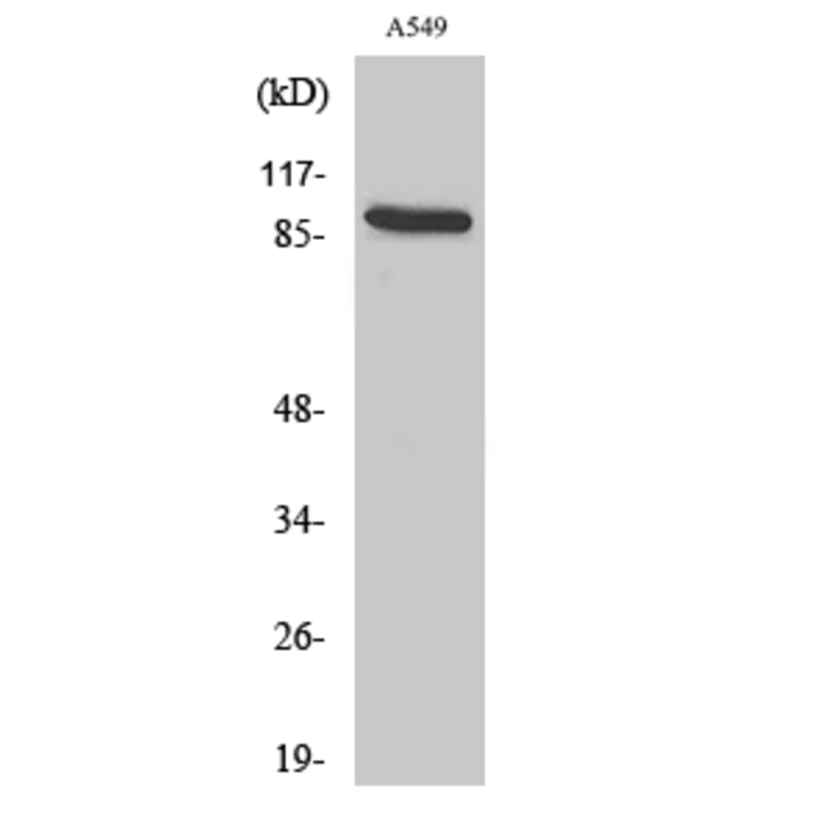 Western Blot - Anti-CDH16 Antibody (C12091) - Antibodies.com