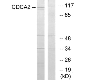 Western Blot - Anti-CDCA2 Antibody (C12173) - Antibodies.com