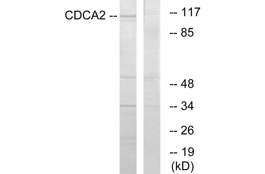 Western Blot - Anti-CDCA2 Antibody (C12173) - Antibodies.com