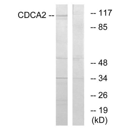 Western Blot - Anti-CDCA2 Antibody (C12173) - Antibodies.com