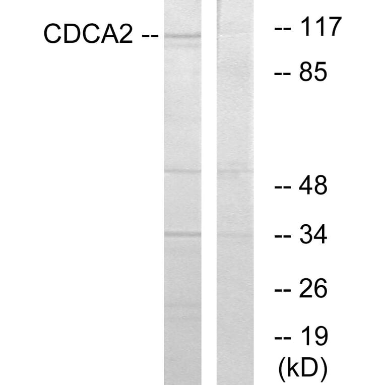 Western Blot - Anti-CDCA2 Antibody (C12173) - Antibodies.com