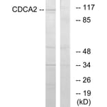 Western Blot - Anti-CDCA2 Antibody (C12173) - Antibodies.com