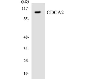 Western Blot - Anti-CDCA2 Antibody (R12-2598) - Antibodies.com